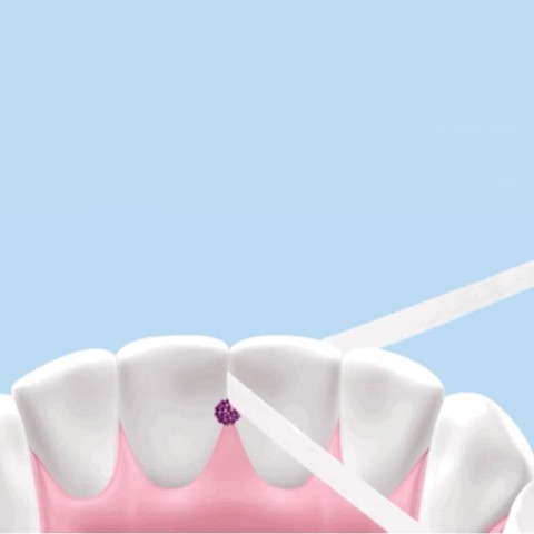 Зубная нить Xiaomi Dr. Bei-4